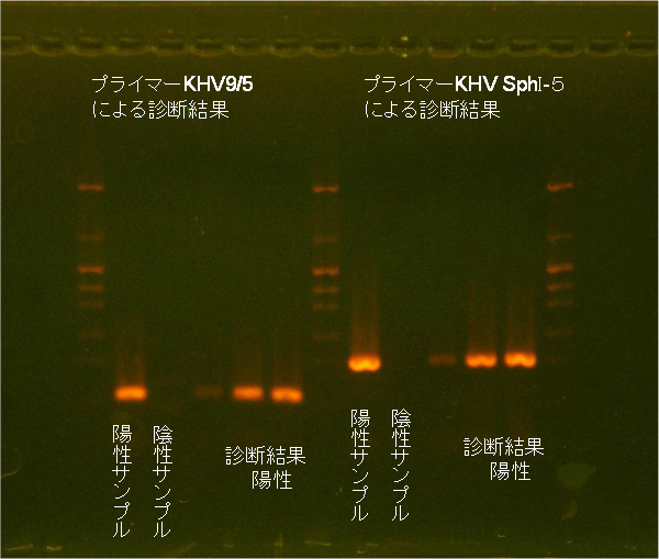 PCR検査結果